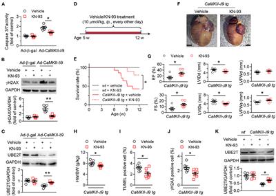 CaMKII-δ9 Induces Cardiomyocyte Death to Promote Cardiomyopathy and Heart Failure